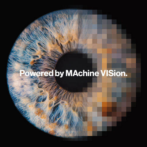 Eye